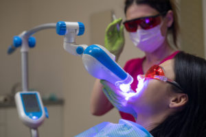 laser teeth whitening