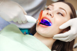 Is It Worth Getting Your Teeth Whitened At The Dentist Procedure