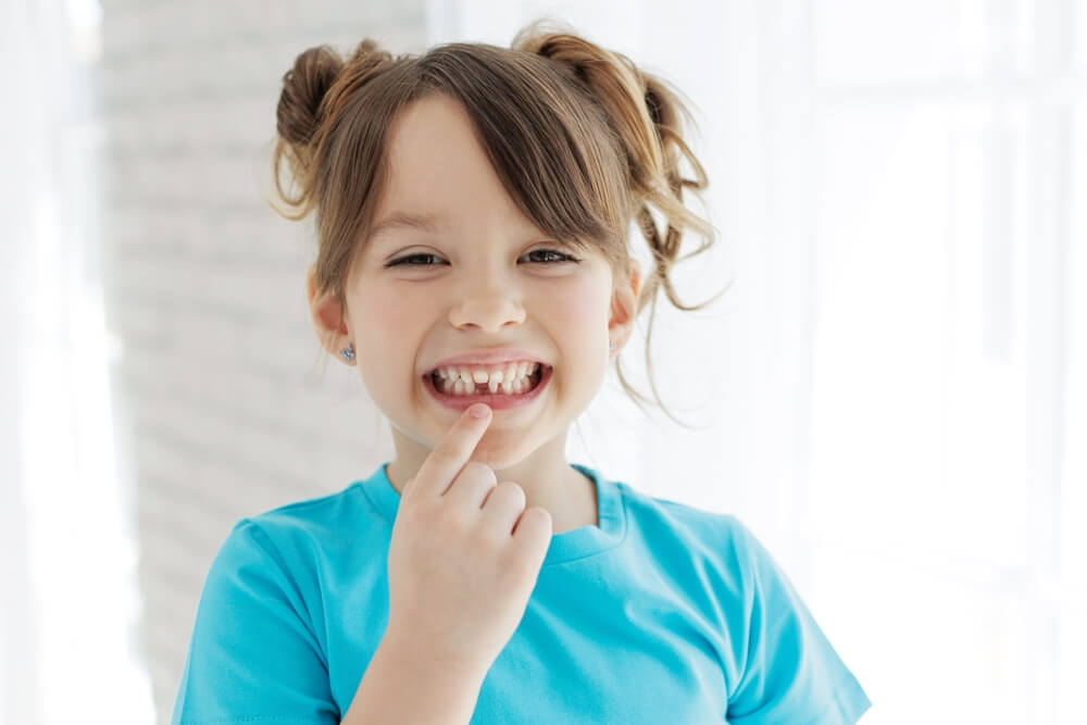 Fluorosis on Baby Teeth: Causes, Symptoms, and Treatment